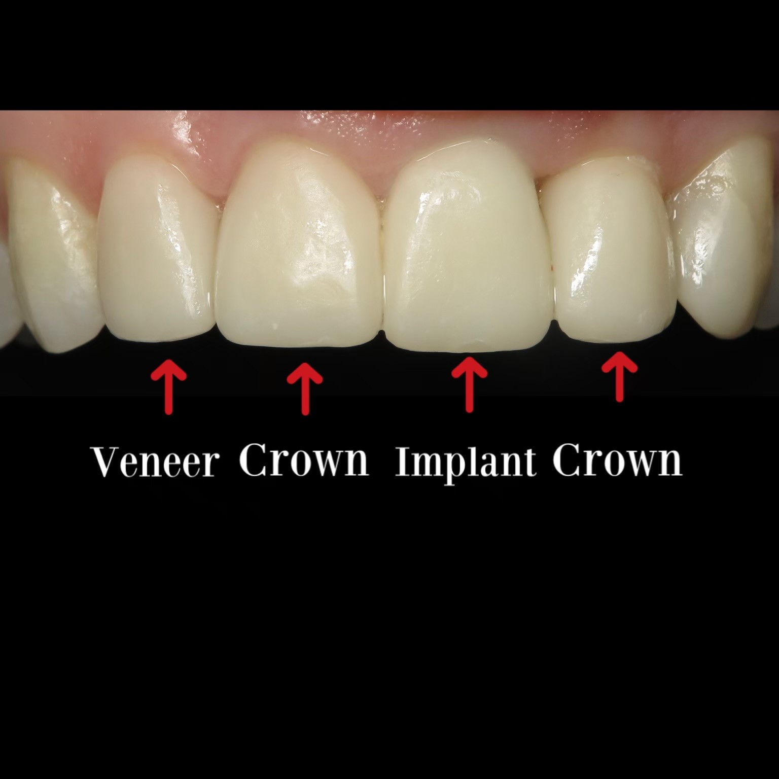 Cosmetic Dentistry in Lincoln in Lincoln